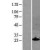 Western Blot: SOCS1 Lysate [NBL1-16325] - Western Blot experiments. 
Left-Control; Right -Over-expression Lysate for SOCS1